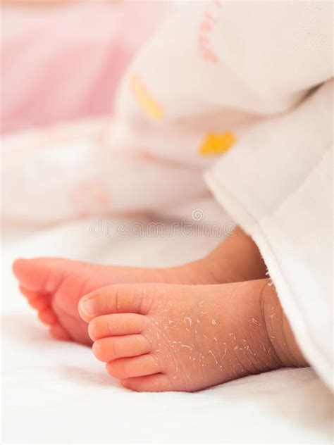 Closeup Instep Or Foot Of A Newborn With A Skin Peeling On White Cloth
