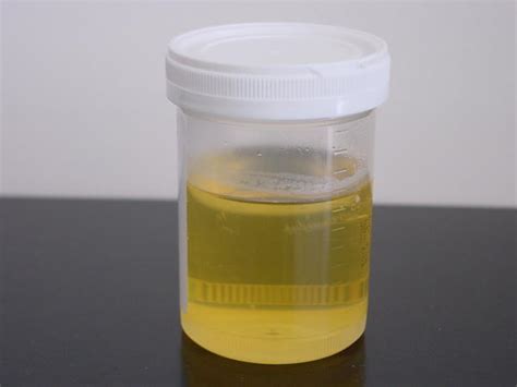 Positive Nitrates In Urine During Pregnancy