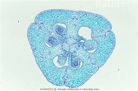 Cross Section Of A Lily Ovary Lilium Sp Lm X