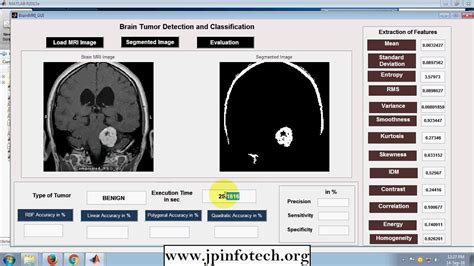 Brain Tumor Detection And Classification Matlab Final Year Project