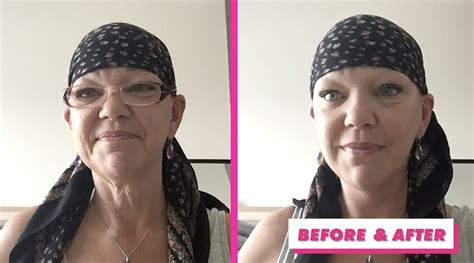 Staci And Hutch A 56 Year Old Woman Gives Herself A Facelift Using Tape Ks95 94 5