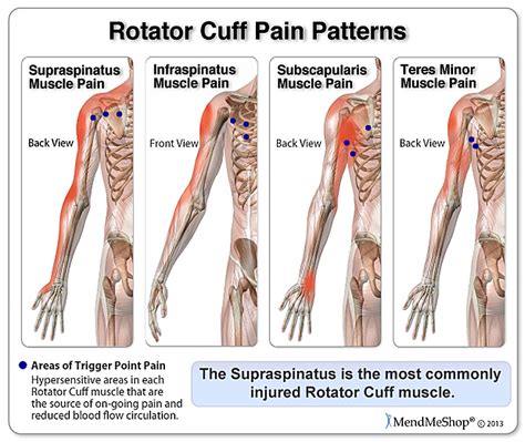 Santa Barbara Massage And Bodywork Balance In Motion Rotator Cuff