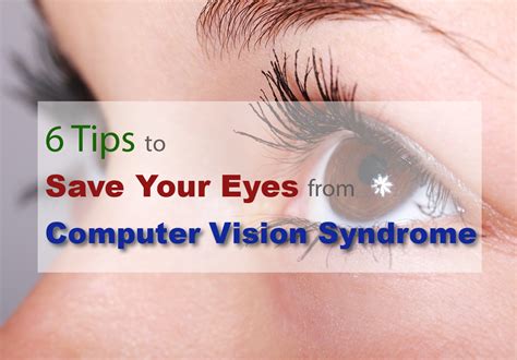 6 Tips To Save Your Eyes From Computer Vision Syndrome Shaozhi On The Net