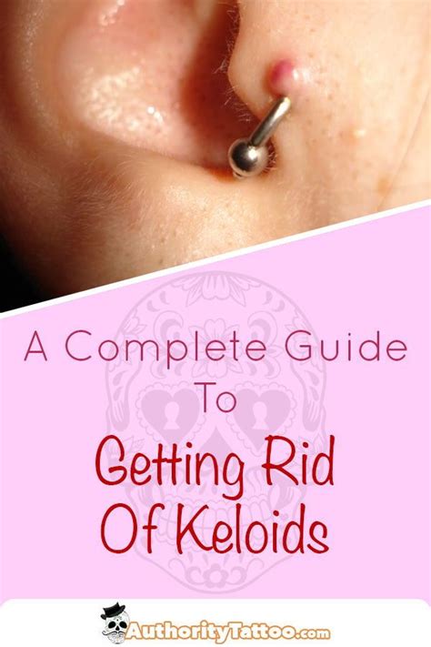 Keloid Scars From Industrial Piercing