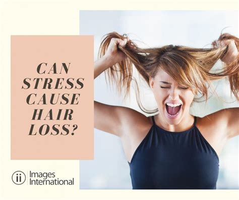 can stress cause hair loss images international