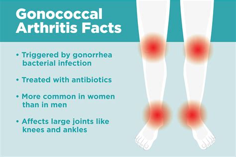 What Is Gonococcal Arthritis Understanding Symptoms Causes And Treatment