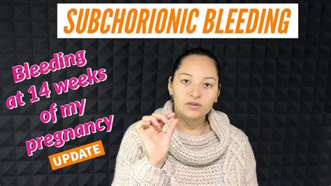 Subchorionic Bleeding Subchorionic Hematoma Bleeding At 14 Weeks Of