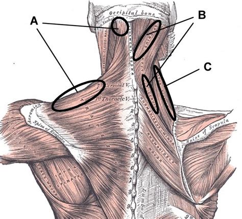 Striated Shoulderneck Muscles In Humans 60 Best Images About My Pain