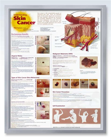 Skin Cancer Exam Room Anatomy Posters Clinicalposters