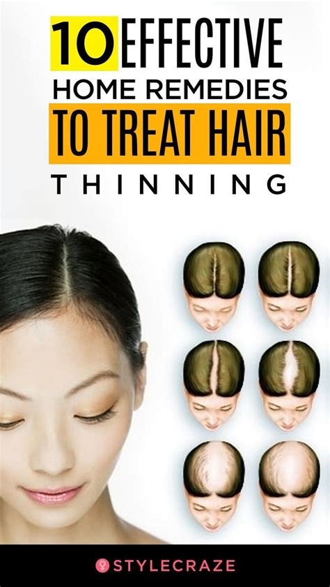 Home Remedies For Thinning Hair Tips And Faqs Best Simple Hairstyles