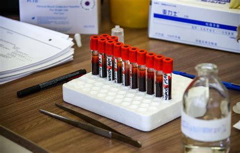 Without getting too technical, a vector is an engineered virus without the ability to replicate or multiply. Side effects of Russian coronavirus vaccine revealed