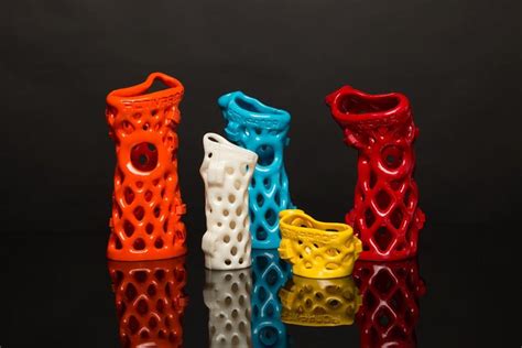 3d Printing The Casts Used To Set Broken Bones Improves Patient Outcomes