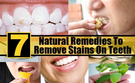 .around the problematic tooth, the other end being tied to a door and then the door being slammed so the tooth gets pulled out by the weight of the door. 7 Natural Remedies To Remove Stains On Teeth | DIY Health Remedy