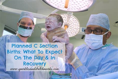 Planned C Section Births What To Expect On The Day And In Recovery Sparkles And Stretchmarks