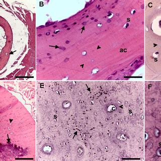 Compact bone, also called cortical bone, is the hard, stiff, smooth, thin, white bone tissue that surrounds all bones in the human body. Histology of Compact bone in reptiles | Download ...