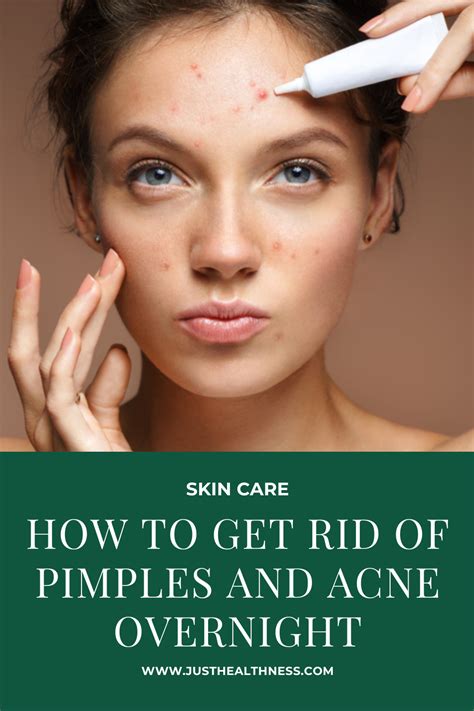 how to get rid of pimples and acne overnight how to get rid of pimples acne overnight home