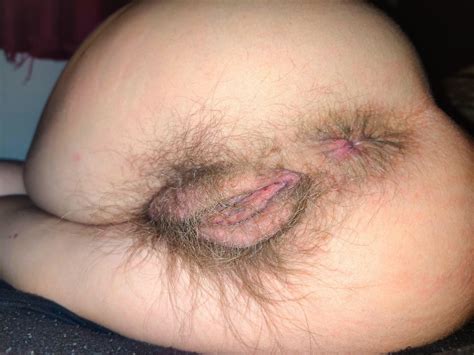 Her Hairy Ass Crack Pics Xhamster