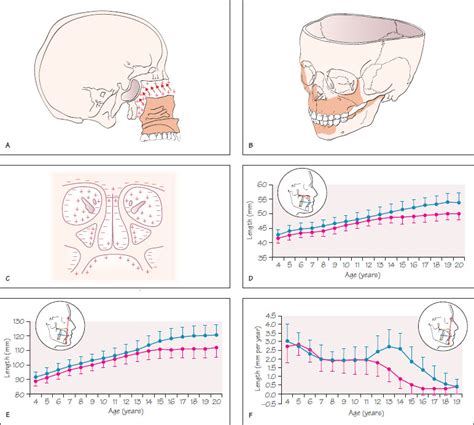 4 Growth And Development Of The Naso Maxillary Complex Pocket Dentistry