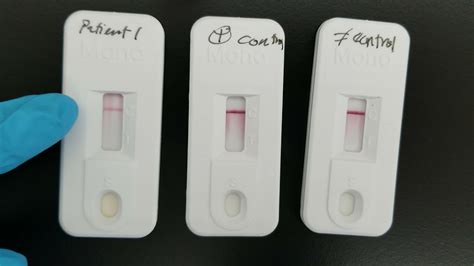 Immunology Infectious Mononucleosis Test Youtube