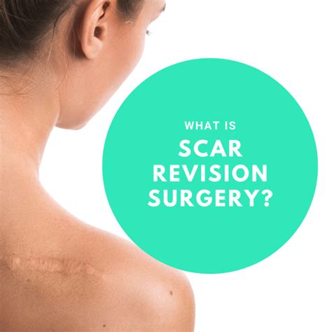 What Is Scar Revision Surgery Annapolis And Severna Park Md