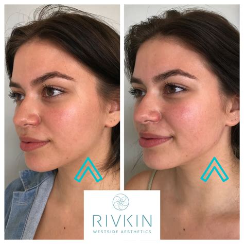 How To Create A Jawline - Create Info