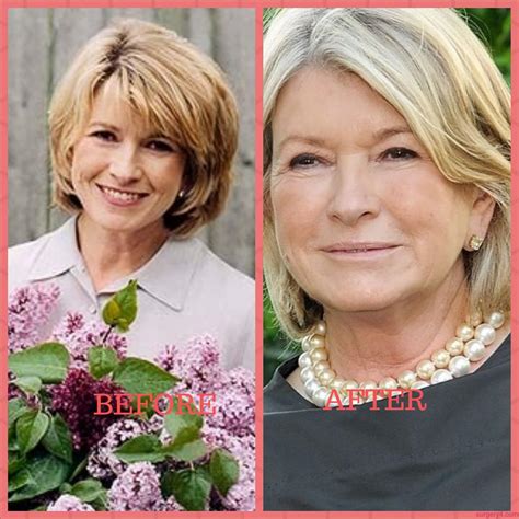 Martha Stewart Plastic Surgery Photos Before And After ⋆ Surgery4