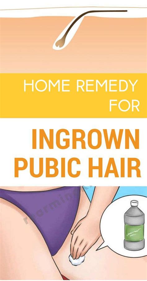 Home Remedy For Ingrown Hair Ingrown Hair Remedies Ingrown Hair Remedies Bikini Ingrown Hair