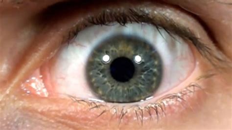 Ţi se zbate ochiul Este un motiv REAL de îngrijorare Simptomele care trebuie să te pună în ALERTĂ