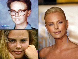 Chatter Busy Charlize Theron Plastic Surgery Acne On Nose Plastic
