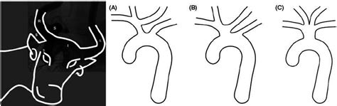 Left Panel Angiographic Appearance Of The Bovine Aortic Arch Whereby
