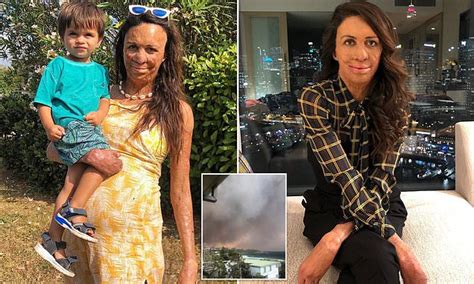 Turia Pitt Vows To Help Rebuild Small Businesses In Fire Affected Towns