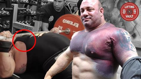 The Worst Pec Tear In Powerlifting History Youtube