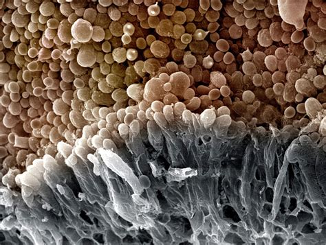 Mushroom Spores (agaricus Bisporus) Photograph by Science Stock ...