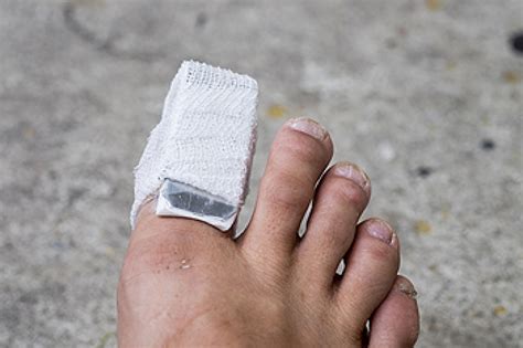 How Long Does A Broken Toe Take To Heal