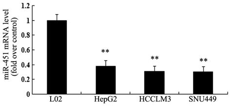 mir 451 potential role as tumor suppressor of human hepatoma cell growth and invasion