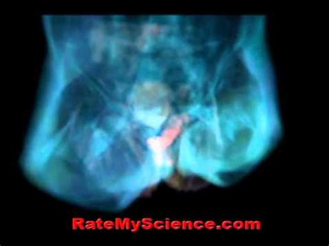 Sex Under Mri Anatomy Of Love Rate My Science Youtube