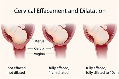 What Happens To Your Cervix During Birth Or Labor Dilation And