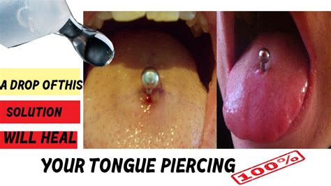 tongue piercing infection symptoms treatment prevention at home remedy infected piercings