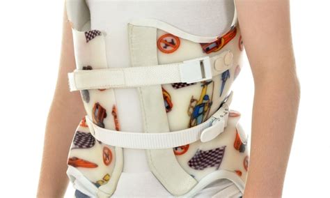What Are The Different Types Of Scoliosis Braces