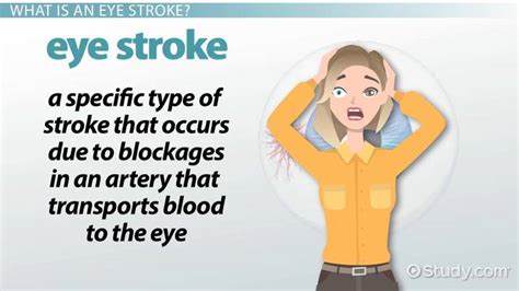 Eye Stroke Treatment And Recovery Lesson