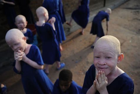 Children With Albinism Take A Break On January 25 2009 In A