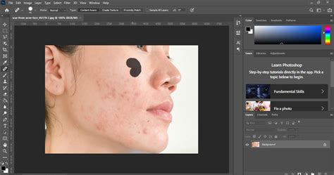 Cara Menghilangkan Jerawat Di Wajah Menggunakan Adobe Photoshop Blog