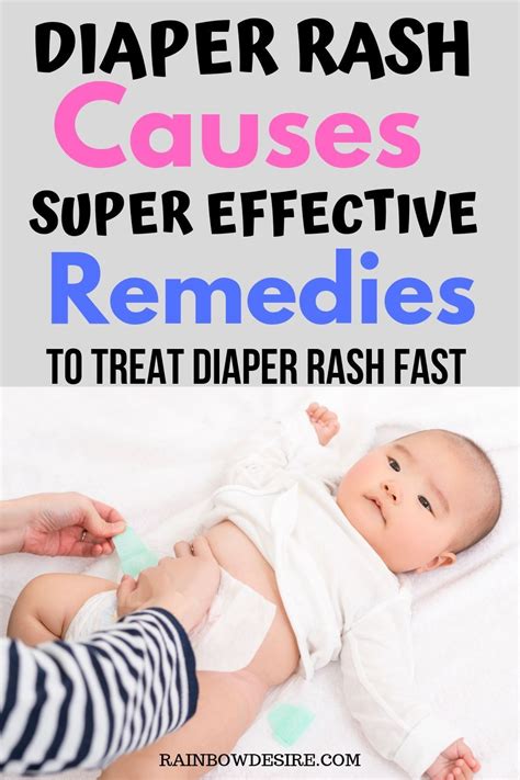 Baby Diaper Rash Causes And Effective Ways To Treat Diaper Rash