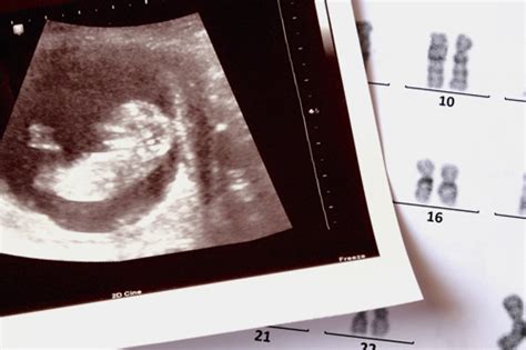 Pregnant Prenatal Genetic Testing Explained