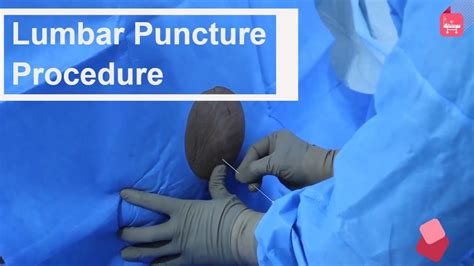 Lumbar Puncture Spinal Tapping Step By Step Procedure In 2022