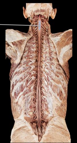 Femoral Triangle Cadaver Human Anatomy Cadaveric Dissection 43c