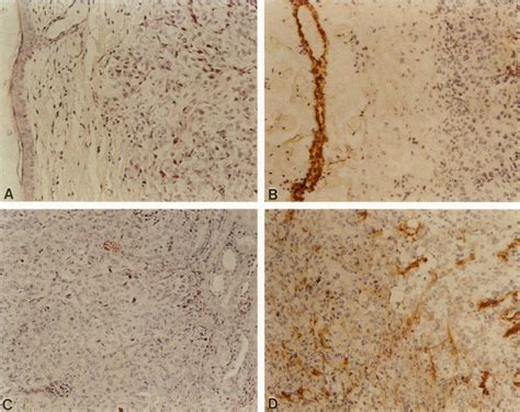 Histology Of SN12PM6 Tumors Growing In Nude Mice A SC Tumor 4 Weeks