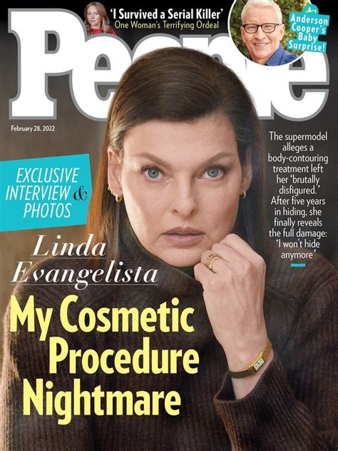 Linda Evangelista Speaks Out After Cosmetic Surgery Nightmare Canadacom