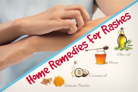 Skin Rash Home Remedies