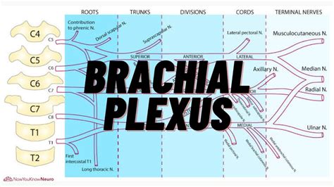Brachial Plexus Palsy Easy Explained Orthofixar Brachial My XXX Hot Girl